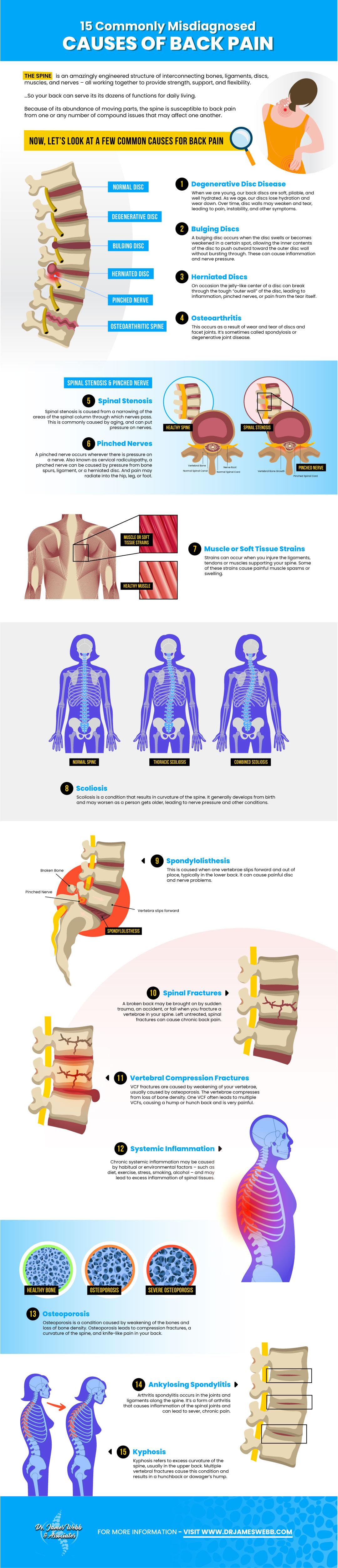 15 Commonly Misdiagnosed Causes Of Back Pain Infographic Dr James Webb