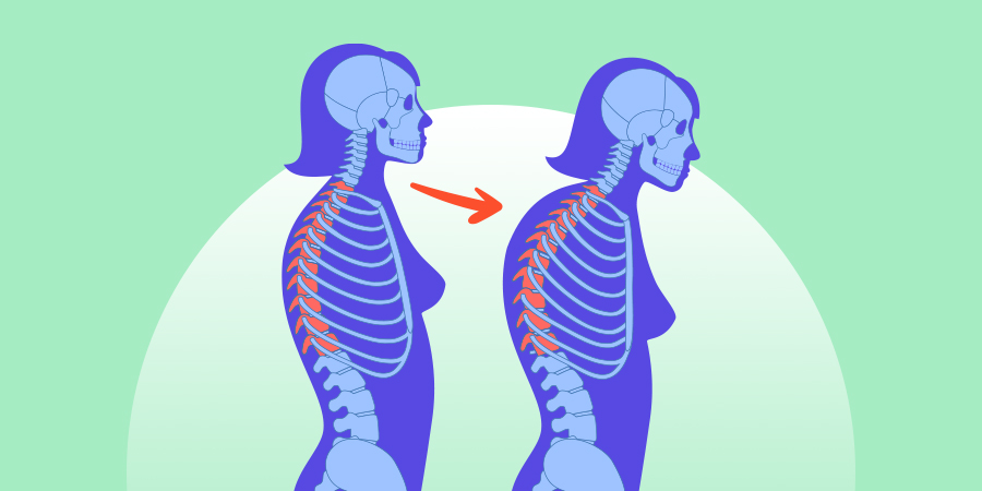 compression-fracture-diagnosis