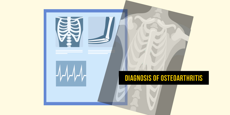 Diagnosis of Orthoarthritis