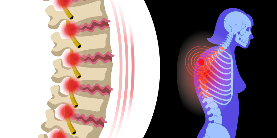 Osteoarthritis Featured Image